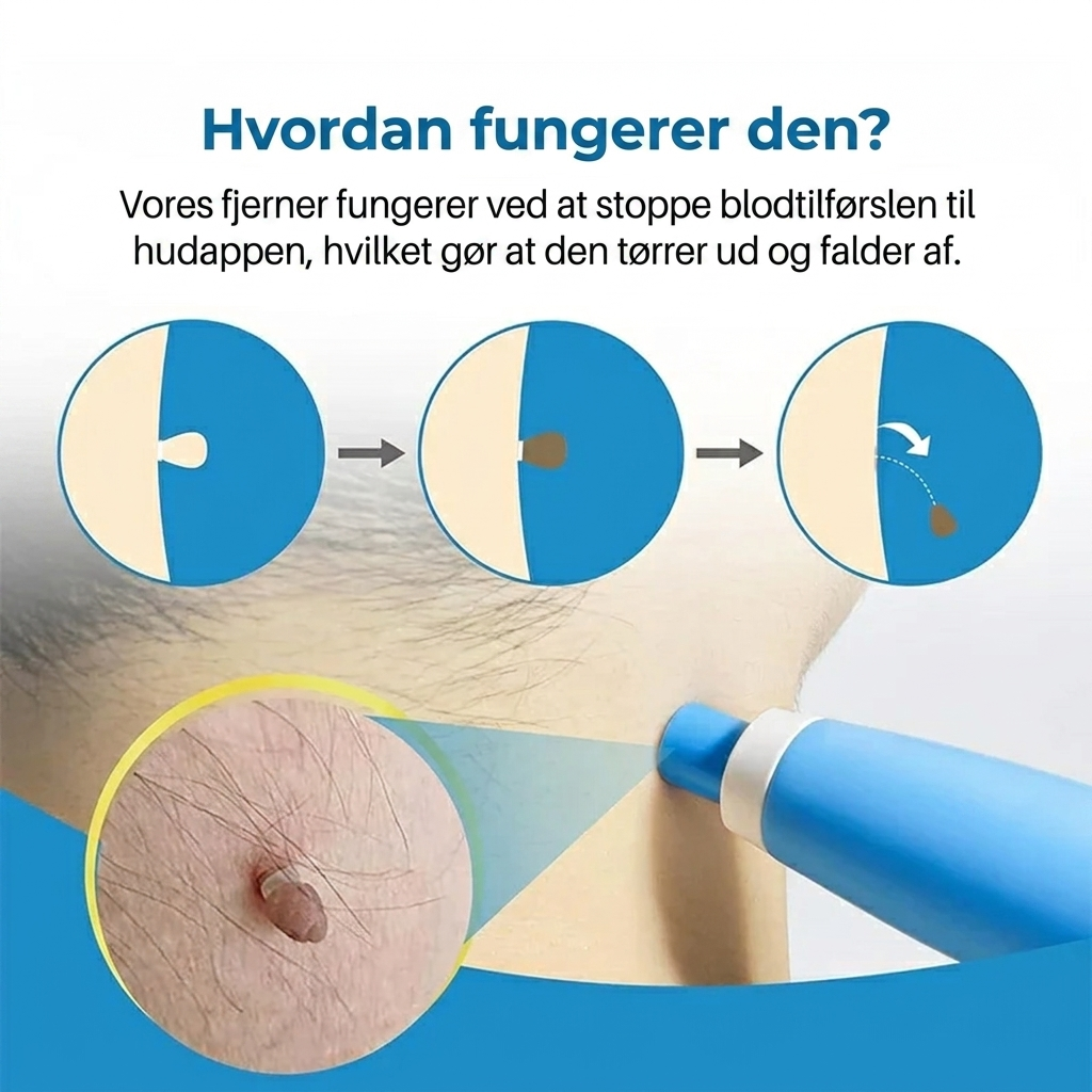 Skinovas fjernelse af hudflige