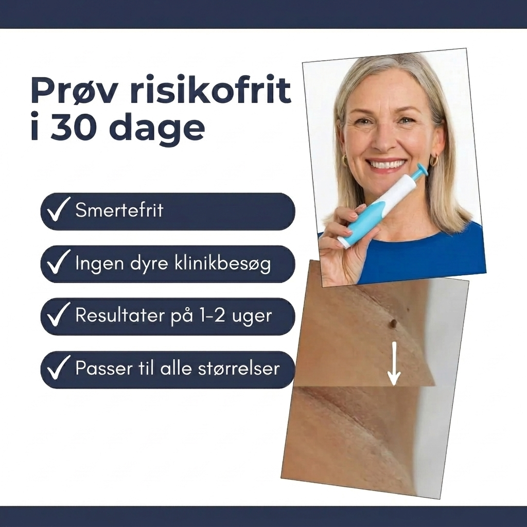 Skinovas fjernelse af hudflige