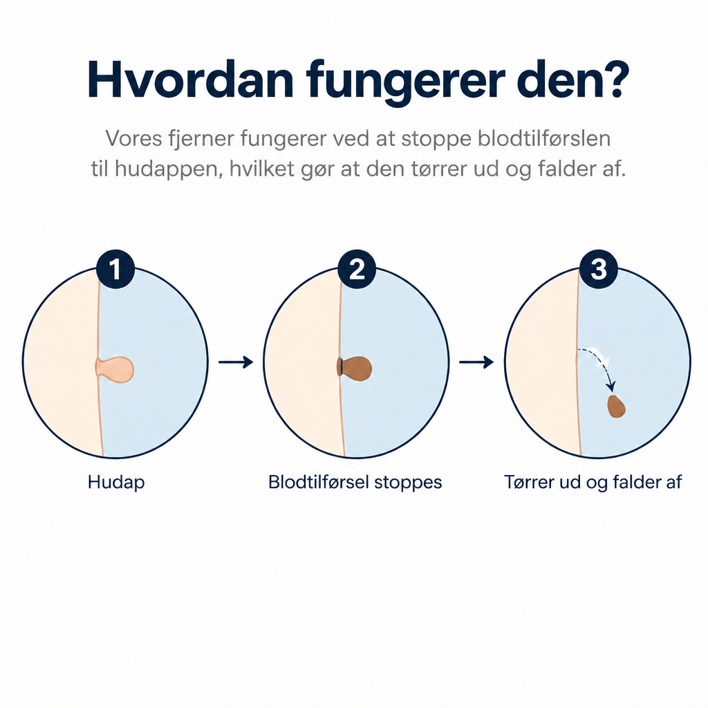 Skinovas fjernelse af hudflige