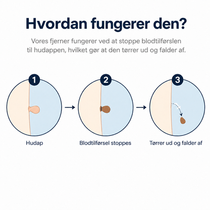 Skinovas fjernelse af hudflige